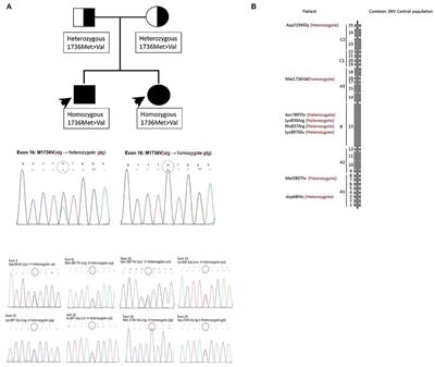 A Novel Phenotype of the Factor 5 Gene Mutation (Homozygote Met1736Val and Heterozygote Asp68His) Is Associated With Moderate Factor V Deficiency